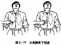 胸外心脏按压术:寻找胸骨下切迹