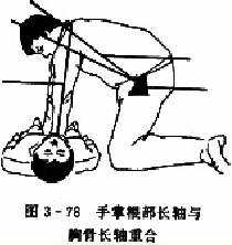 胸外心脏按压术:手掌根部长轴与胸骨长轴重合