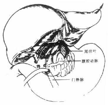 肝门横断后，将肝脏向上翻转，逐根结所肝短静脉
